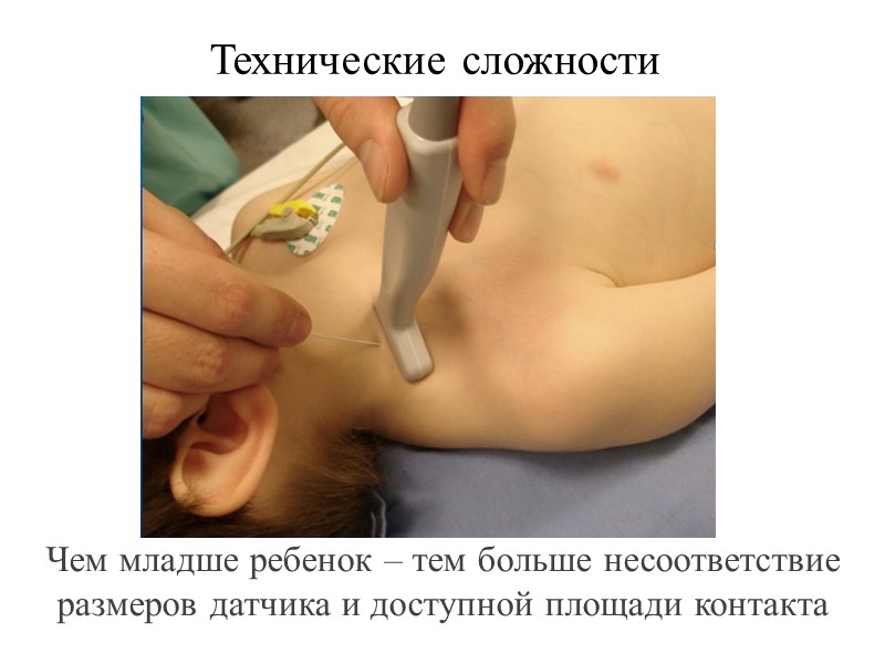 Технические сложности Чем младше ребенок – тем больше несоответствие размеров датчика и доступной площади